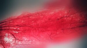 Scopri di più sull'articolo Computing patient-specific hemodynamics in stented femoral artery models obtained from computed tomography using a validated 3D reconstruction method