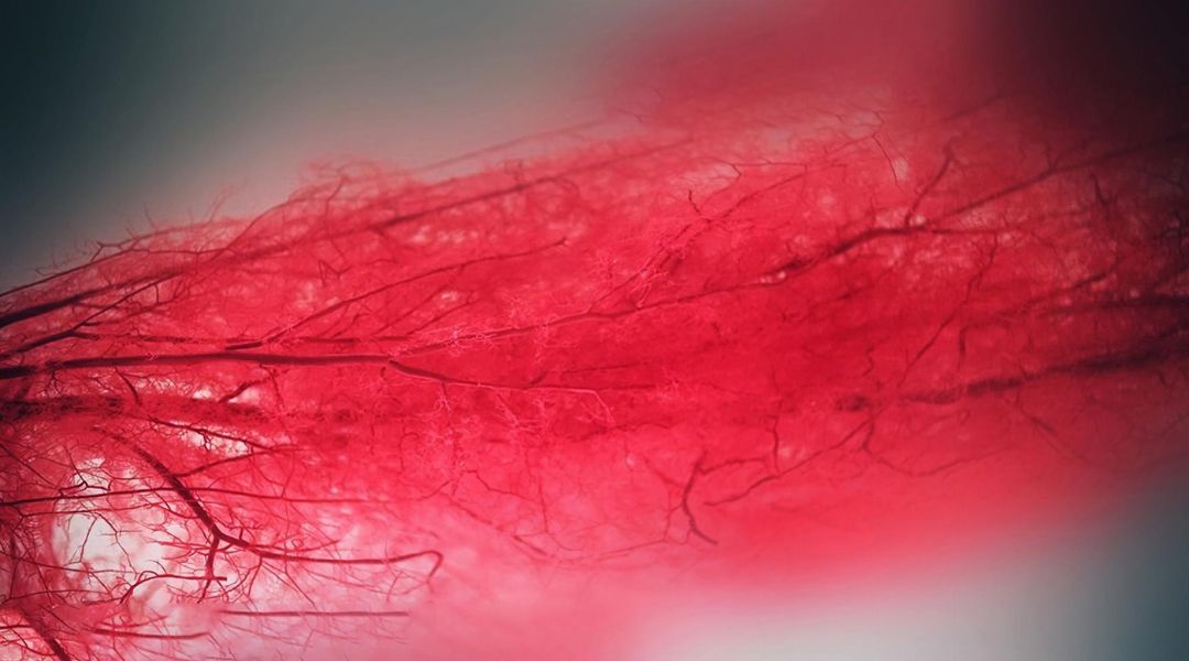 Computing patient-specific hemodynamics in stented femoral artery models obtained from computed tomography using a validated 3D reconstruction method