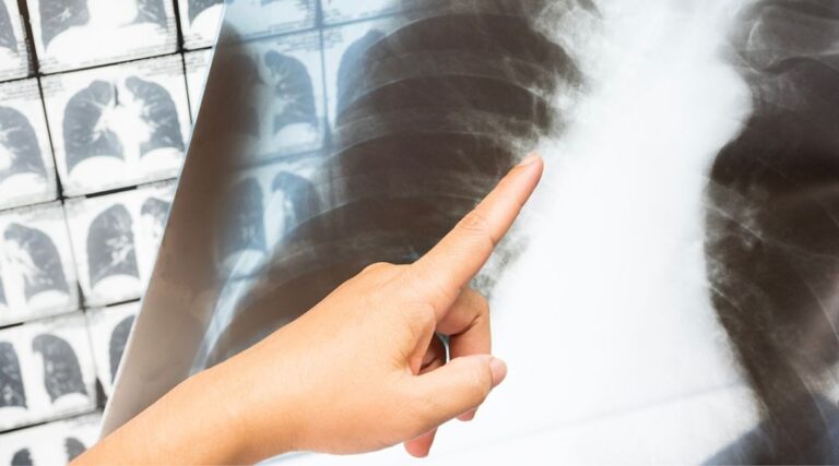 Read more about the article MS HUMANAID: Artificial Intelligence Supporting COVID-19 Diagnosis