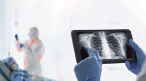 COVID-X finanzierà un progetto synbrAIn sulle immagini radiografiche