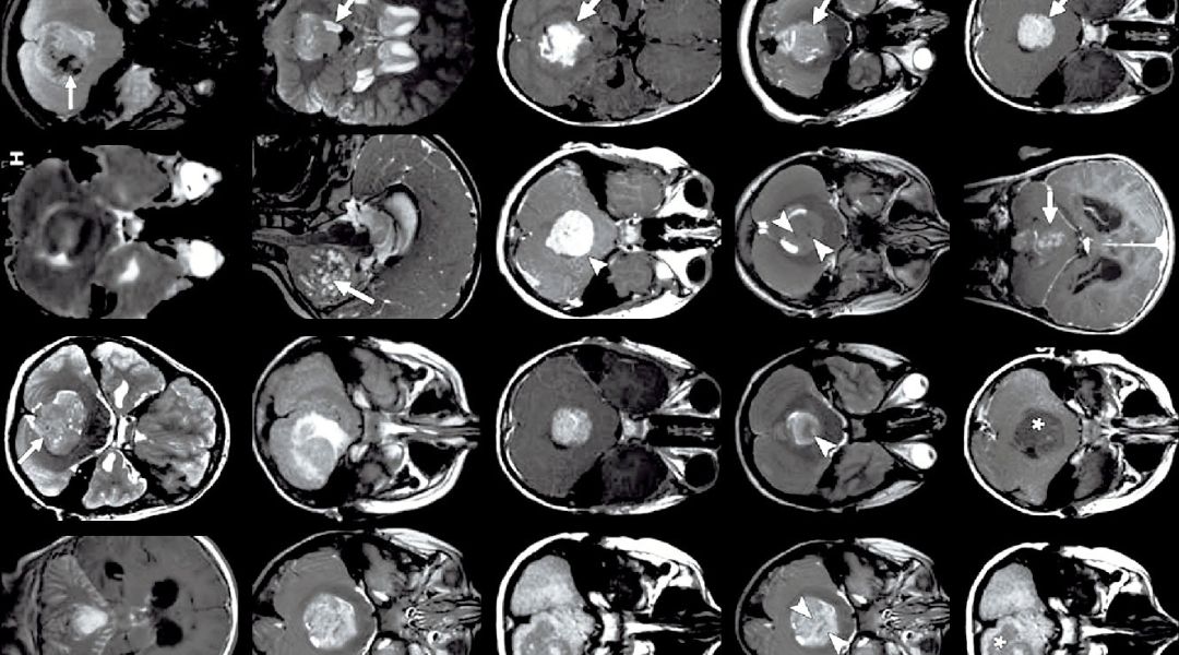 Assessment of the effect of intensity standardization on the reliability of T1-weighted MRI radiomic features: experiment on a virtual phantom