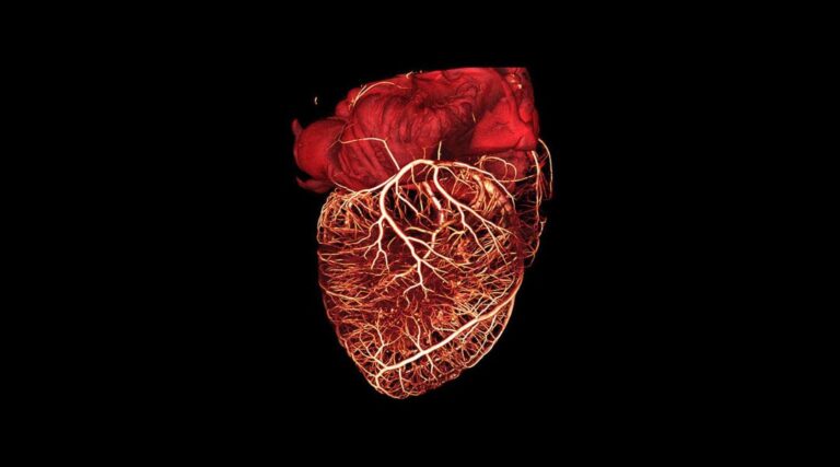 Scopri di più sull'articolo A Patient-Specific Study Investigating the Relation between Coronary Hemodynamics and Neo-Intimal Thickening after Bifurcation Stenting with a Polymeric Bioresorbable Scaffold
