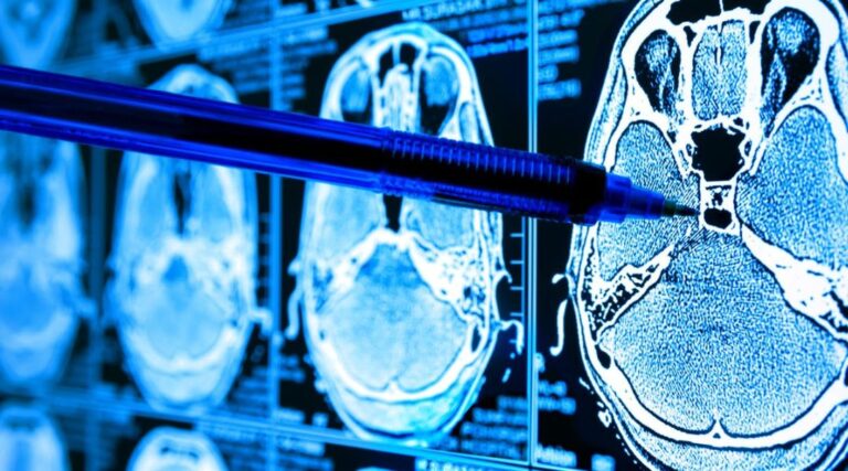 Read more about the article synbrAIn Announces New Strategic Partnership with EMME ESSE