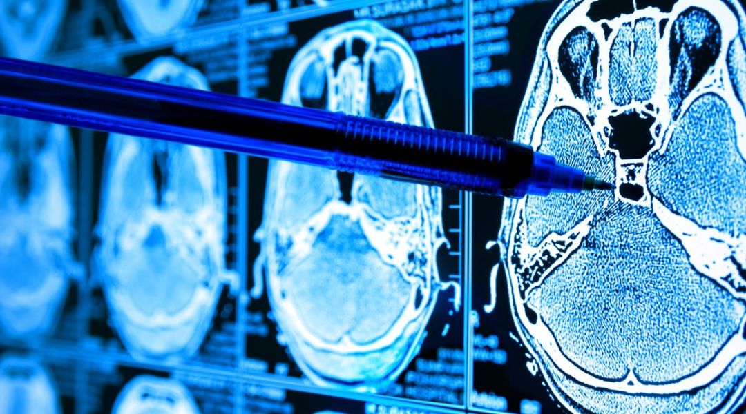 Partnership tra synbrAIn e EMME ESSE