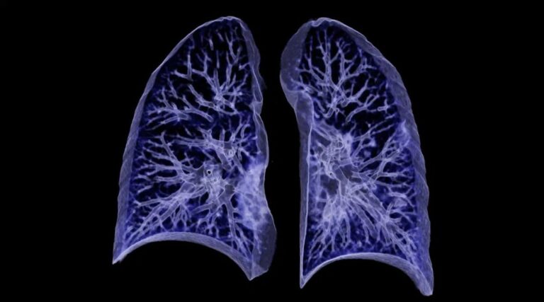Scopri di più sull'articolo Rivitalizzare le attività di regressione tramite moderne procedure di training. Applicazioni nell’analisi delle immagini mediche