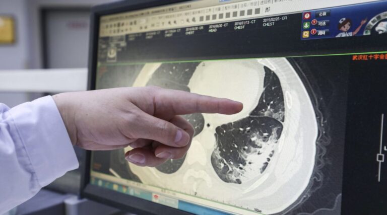 Scopri di più sull'articolo COVID Detection in Chest CTs: Improving the Baseline on COV19-CT-DB