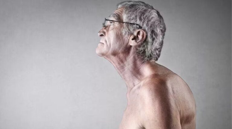 Scopri di più sull'articolo Smartphone-Based Evaluation of Postural Stability in Parkinson’s Disease Patients During Quiet Stance