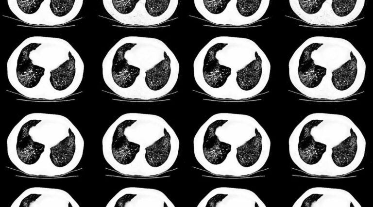 Read more about the article SenticLab, synbrAIn’s Research Partner, Develops a Solution to Identify Tuberculosis Types from Radiographic Images